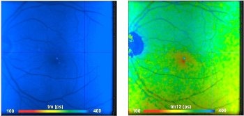 Shifted-Component Model Improves FLIO Data Analysis