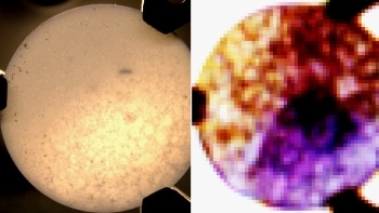 Miniature Laser Crucial for Development of New Medical Sensors