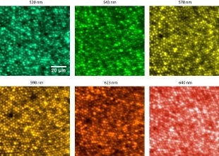 Personalized Approach to Diagnosing Individual Vision Issues