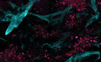 New Microscopy Technique May Help Detect Cancer Metastasis in Real Time