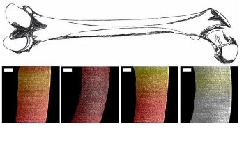 New Endoscopic System Offers Real-Time Quantitative Data on Cartilage Thickness