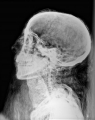 Computed Radiography System Helps Uncover Secrets from the Past