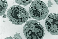 New Model to Improve Quality of Diffusion-Weighted Imaging of Tumors