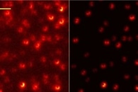 Super-Resolution Microscopy Reveals the Dynamics of Alzheimer-Linked Protein Complex