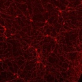 Blind to Light, Normal Vision Intact
