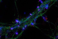 Researchers Develop New Technique for Live-Cell Fluorescent Imaging