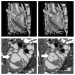New Micro-CT System Produces Images Sharp Enough to Detect Motion of Arteries in Rats and Mice