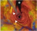 New Optical Imaging Technique Gives Detailed Look at the Interior of Human Coronary Arteries