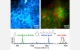 Stimulated Raman scattering (SRS) Label-Free Imaging Technique Set to Revolutionize Biomedical Imaging