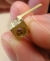Princeton Engineers Develop New Type of Laser for Medical Applications