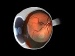 Project Could Save the Vision of Millions