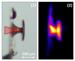 Scientists Accelerate Protons to Energies Using Laser-Particle Acceleration