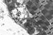 Microscopy Helps Study Role of Nondegradative Autophagosomes in Degenerative Disease