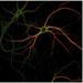 Researchers Used High-Resolution Microscope to Find How Brain Encodes Memories