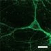 Different Colors of Light Can Help Treat Abnormal Brain Activity