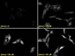Scientists to Measure Zinc Level in Human Body Using Fluorescence Microscopy