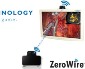 NDSsi Announces FDA Clearance for ZeroWire Duo Full HD Video System