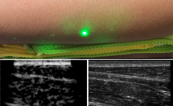 Non-contact Laser Ultrasound Enables Diagnosis at a Distance