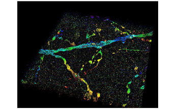 High-Resolution Imaging Technology Observes Structures in Cells