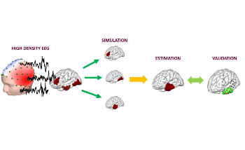 New System for High-Density EEG Imaging of Brain Activity