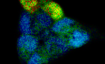 PicoQuant’s rapidFLIMHiRes Combines Ultra Fast FLIM Imaging with Outstanding 10 ps Time Resolution