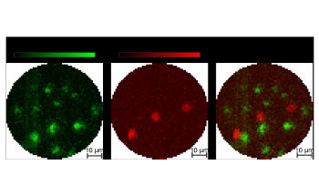 New Endoscope Combines Photoacoustic and Fluorescence Imaging in a Single Device