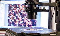 New Technique Enables Precise Optical Imaging of Single Proteins