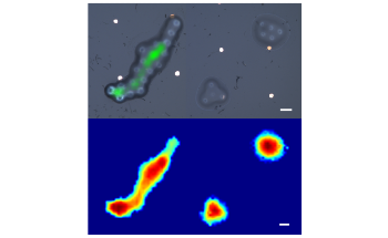 New Fiber-Optic Imaging Probe for More Effective Diagnoses of Various Diseases
