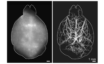 New Imaging Technique Helps Visualize Deep Cerebral Microvasculature in Mouse Brain
