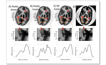 New Imaging Technique has Potential to Detect Neurological Disorders