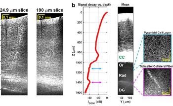 New Label-Free, Non-Invasive Optical Microscopy to Image Deep Inside the Brain
