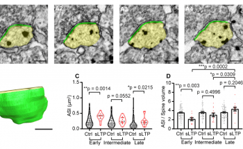 New Imaging Technique to Capture Single Spine Structural Plasticity