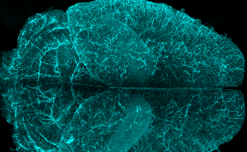 Imaris launches version 9.8: Allowing Users to Better Analyse Large Volume Microscopy Datasets