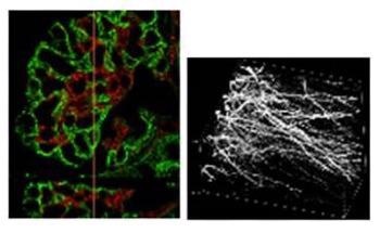 Crestoptics Introduces DeepSIM Super Resolution Confocal Microscope Module