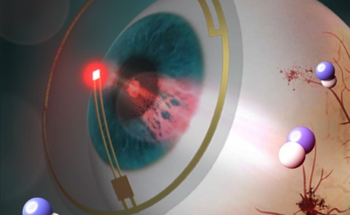 Early Treatment System for Diabetic Retinopathy Using Smart LED Contact Lenses