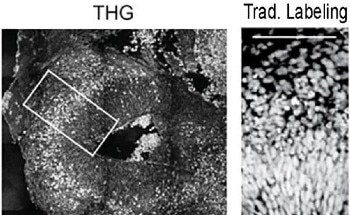 Imaging Technology Illustrates the Migration Path of Neurons in Rett Syndrome