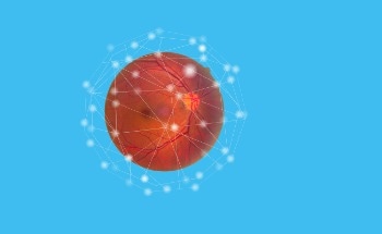 Optical Coherence Tomography Helps Study Increased Macrophage-Like Cell Density in Retinal Vein Occlusion