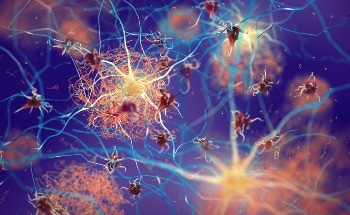 Study Uses Hyperspectral Imaging for Early Alzheimer's Detection