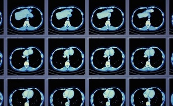 Hybrid Imaging System with CT and Photon Counting for High-Resolution Imaging