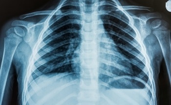 Improved X-Ray Imaging for Medical and Security Settings