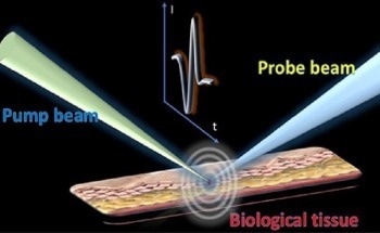 Performing Photoacoustic Lipid Imaging with Remote Sensing