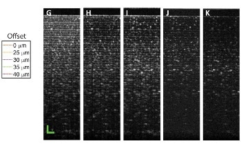 Disease Diagnosis with Deep Light Imaging