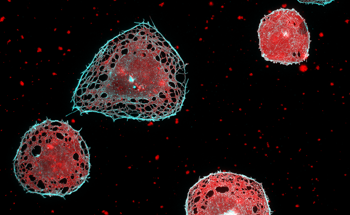Fast Super-Resolution Imaging with New Fluorescence Microscope