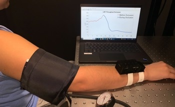 Using Laser Speckle Imaging to Provide Early Warning for Hemorrhages During Labor