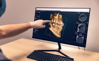 High-Resolution Dual-Energy Cone-Beam CT Imaging with Dual-Layer Flat-Panel Detector