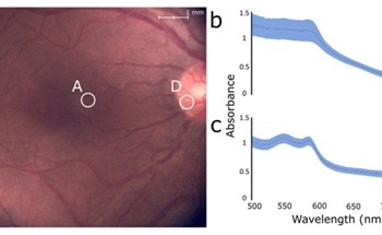 Flexible Imaging Method for Pathology Diagnosis in the Eye Fundus