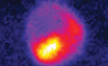 New Technique Enables Ultrafast Imaging of Light-Matter Interactions