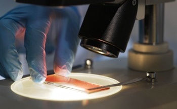 MPN Diagnosis Using Immunofluorescence Microscopy