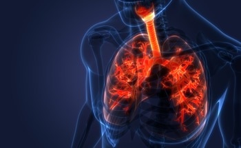 Real-Time Bacterial Detection in CF Patients Using APPI-MS