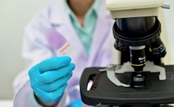 Malaria Detection in Pregnancy: Evaluating RDTs and Microscopy